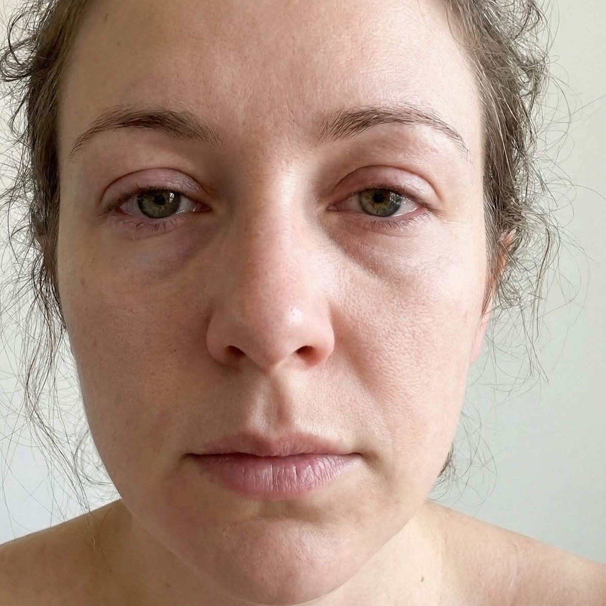 Brighter, More Rested Eyes before