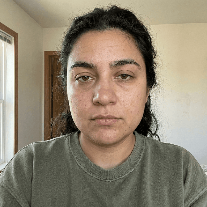 Before PinkSculpt — morning puffiness